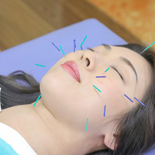 西が丘整骨院美容メニュー施術の様子